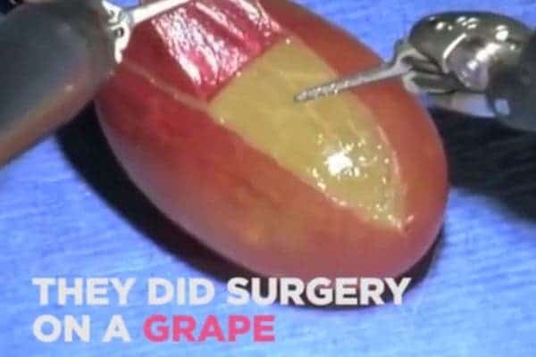 They Did Surgery on a Grape meme